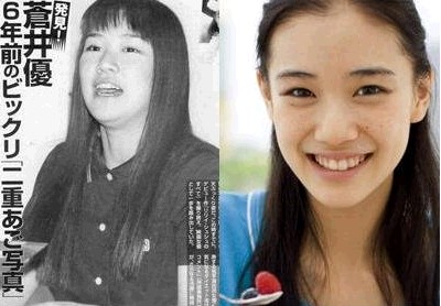女星胖瘦对比照保你决心<a href='http://www.99-jk.com/html/jf/index.html'><u>减肥</u></a>